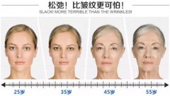 激光祛斑、除皺抗衰老的果怎么樣呢？