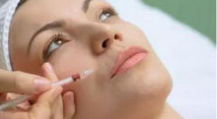 一支玻尿酸需要多少錢？