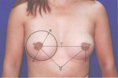 什么樣的乳房才是較美的呢？