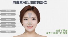 注射瘦臉注射后的不良反應(yīng)