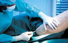 答疑：血壓偏高可以做抽脂手術(shù)嗎？