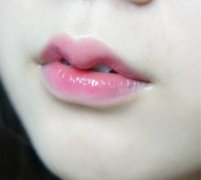 M唇微笑唇的整形手術(shù)介紹和價格！