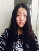 在北京做的硅膠＋耳軟骨隆鼻，大家來看看吧！