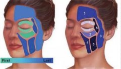 光纖溶脂和透明質(zhì)酸填充術(shù)在面部年輕化整形中