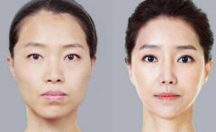 豐蘋果肌的果主要有哪些呢？