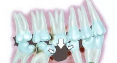 你的牙齒會讓你微笑起來難堪嗎