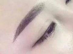 掉痂沒顏色，是沒有做好？