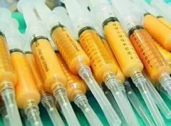 自體脂肪移植的成活率能80％嗎？