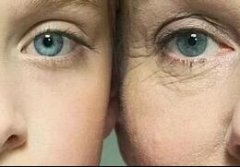 整形有年齡限制嗎？