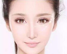 成都美容微針多少錢?