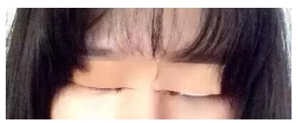 做了雙眼皮+開眼角，我也是萌妹子了!