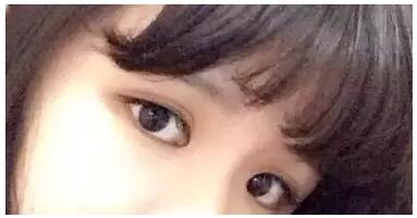 做了雙眼皮+開眼角，我也是萌妹子了!