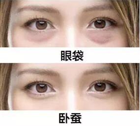 眼袋和臥蠶的區(qū)別