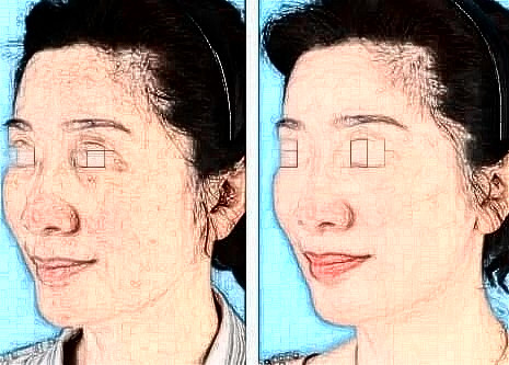 擅長整形項(xiàng)目