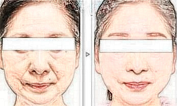 擅長整形項(xiàng)目