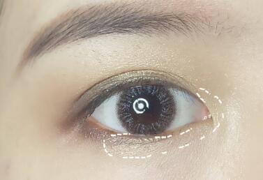 切記術(shù)前不可跟風(fēng)選擇，那合肥105整形的技術(shù)和口碑怎么樣？