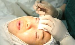 做雙眼皮手術(shù)疼嗎?