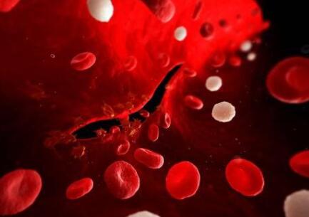 為何不提議女孩在大姨媽期間做隆鼻手術(shù)?