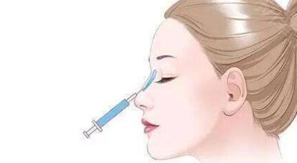 注射隆鼻專家怎樣選擇？教你如何選擇靠譜專家~