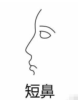 不同的隆鼻方式適合不同鼻部基礎(chǔ)的人群