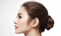 膨體隆鼻假體取出后對(duì)比差別會(huì)不會(huì)很大？