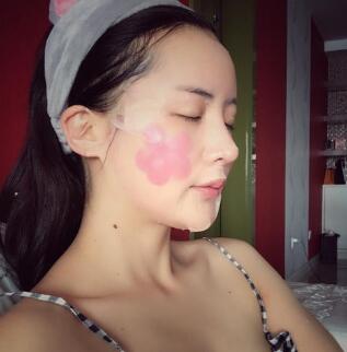 隆鼻術(shù)后，為什么會(huì)出現(xiàn)鼻子假體挪動(dòng)、傾斜?