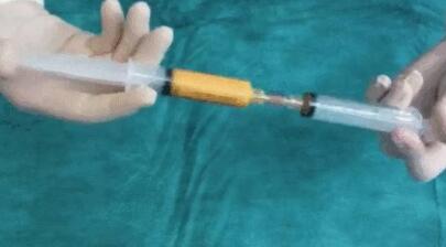 自體脂肪填充有什么風險性?