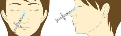 注射隆鼻值得大家做嗎?