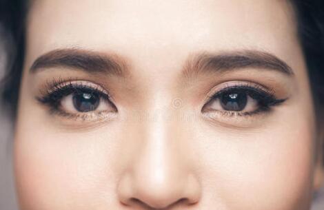 眼窩下陷脂肪填充，是較為好的填充物了！