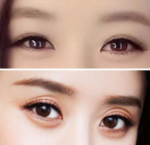 新月型雙眼皮，特點(diǎn)就是兩頭窄、中間寬