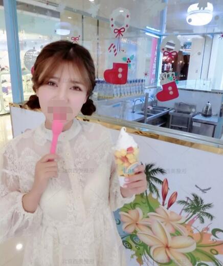 西美的歐式眼案例，也是我們的顏值擔(dān)當(dāng)