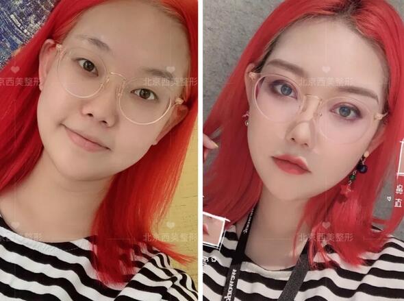 大平行雙眼皮給人的感覺(jué)是時(shí)尚、大氣，適合各種場(chǎng)合擼妝上鏡的果