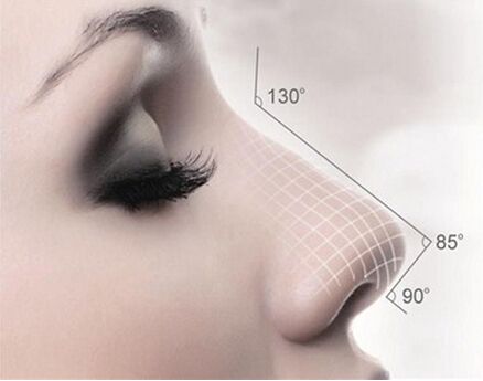 骨粉隆鼻的注意事項