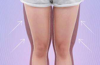 大腿吸脂分以下幾個步驟：