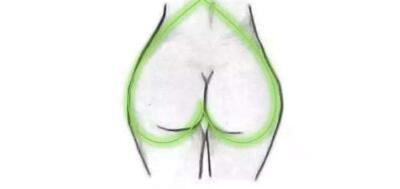 臀部吸脂有什么好處?