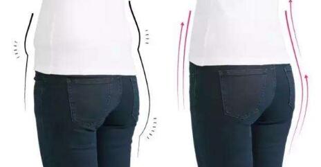 臀部吸脂手術術前該注意哪些呢?