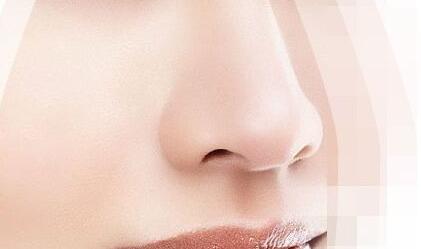 骨粉隆鼻后遺癥有這些！?