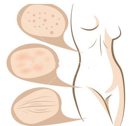 術(shù)后護(hù)理