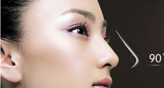 鼻尖成形術(shù)~你與美膩的鼻子只差一個的鼻尖！