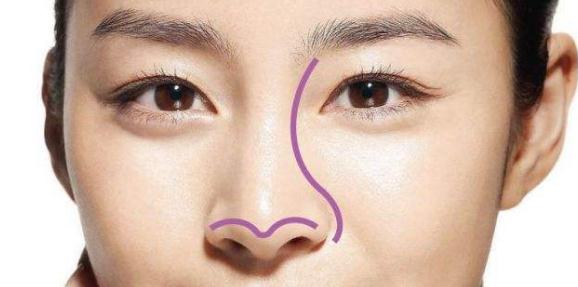 鼻尖成形術(shù)的優(yōu)點：