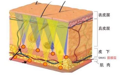 內窺鏡除皺術的優(yōu)點