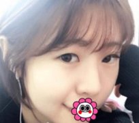 長(zhǎng)沙愛(ài)**張姣姣雙眼皮案例圖~美眼殺傷力真強(qiáng)