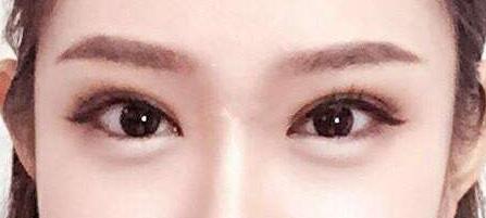 繡眉后的注意事項