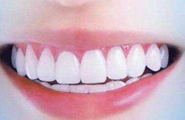 純鈦烤瓷牙的優(yōu)勢