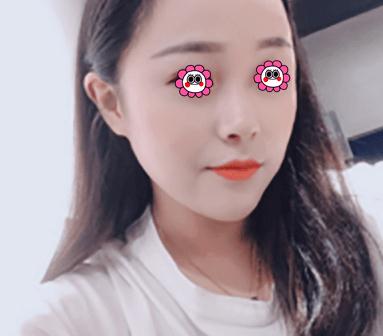 像素激光去痘的恢復(fù)過程