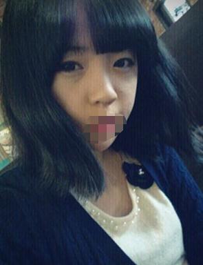 雙眼皮手術(shù)術(shù)前