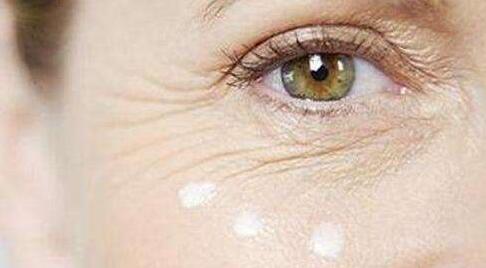 去魚尾紋多少錢？去魚尾紋的方法有哪些？