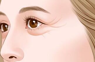 去魚尾紋的方法有哪些？