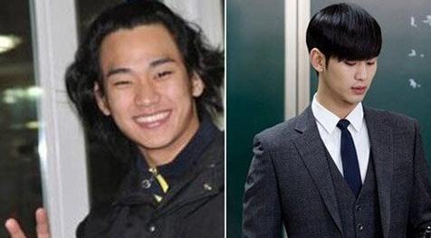 金秀賢的整形表現