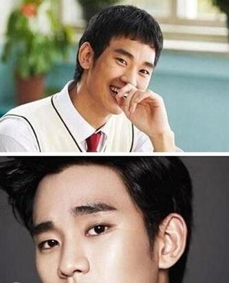 金秀賢的整形對比